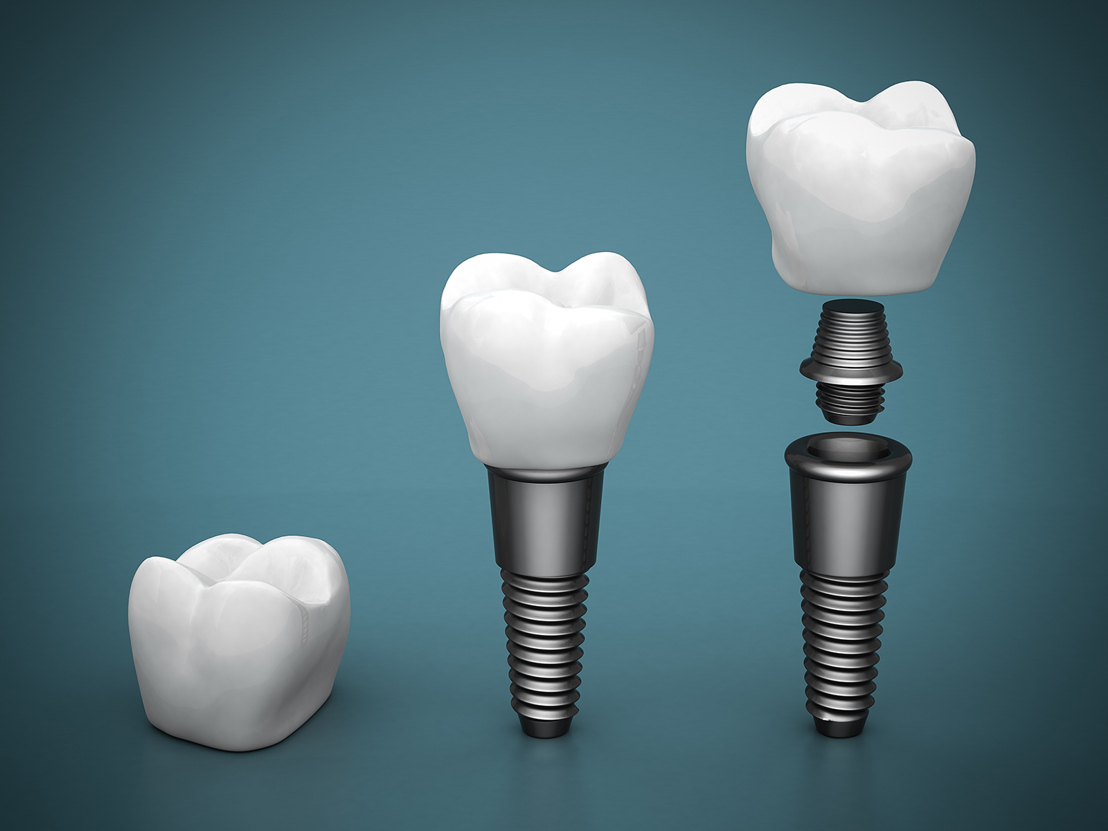 What Can You Eat After An Abutment Surgery 