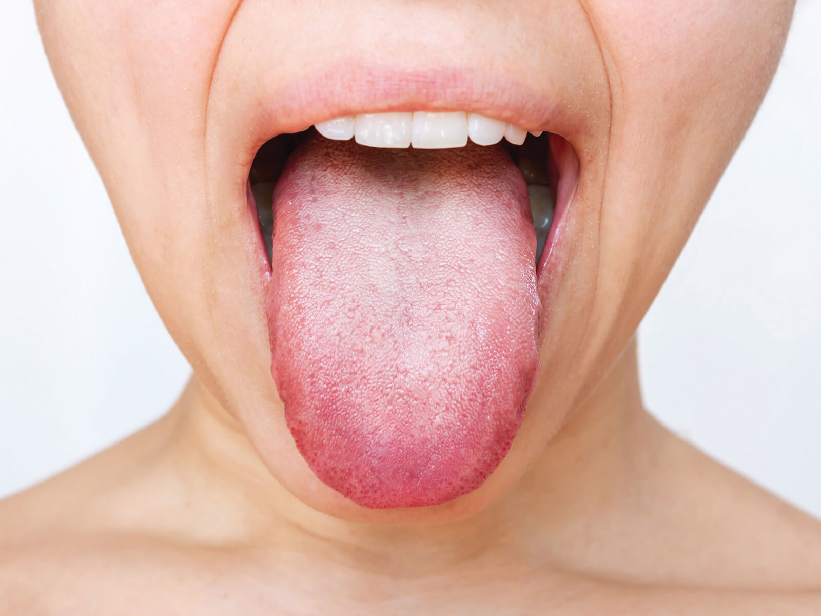 What Is Your Tongue Telling You About Your Dental Health?