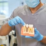 Why Bone Grafts Are Important For Dental Implants